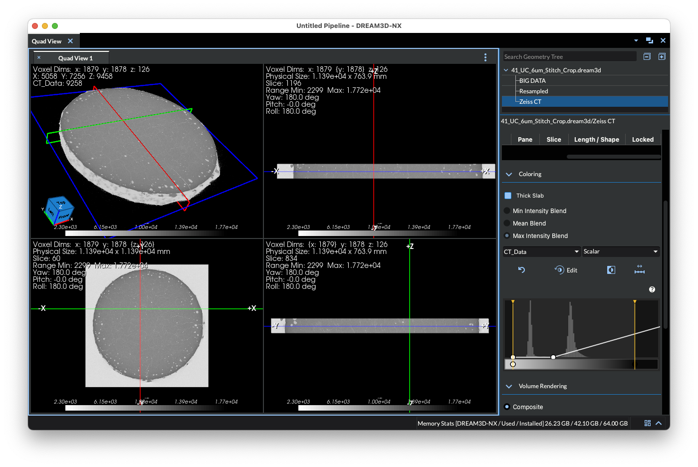 Quad View showing a 3D volume rendering beside three orthogonal slice views